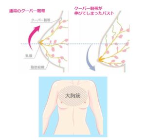 クーパー靱帯と大胸筋の説明図